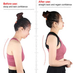 Adjustable Back Posture Corrector